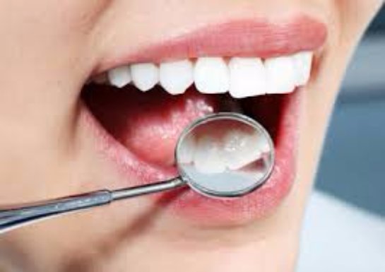 Современная стоматология: установка виниров