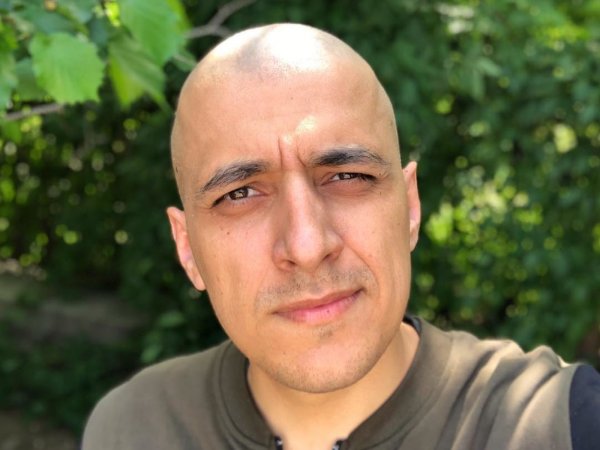 Попал в мир «безресничия»: Больной раком Эд Мацаберидзе рассказал о последствиях химиотерапии