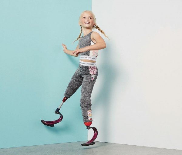 Восьмилетняя жительница Британии с ампутированными ногами стала моделью