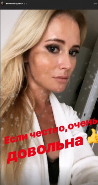 Дана Борисова продемонстрировала ужасные синяки на лице