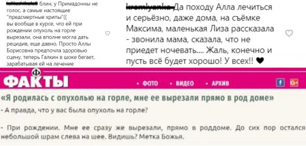 Галкин игнорирует выходы в свет из-за опухоли Пугачевой