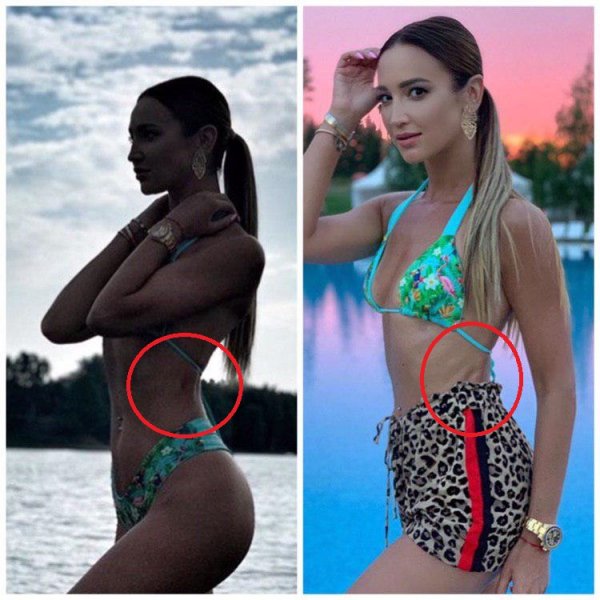 Бузова удалила рёбра - Ольга забыла замазать шрамы в Instagram