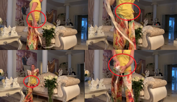 Ноги-спички и распухшие колени: Беременная Волочкова может потерять ребенка из-за анорексии